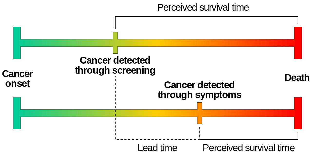 Lead time bias example