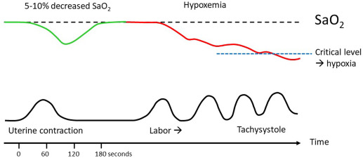 Uterine contractions transiently deplete oxygen delivery to the fetus